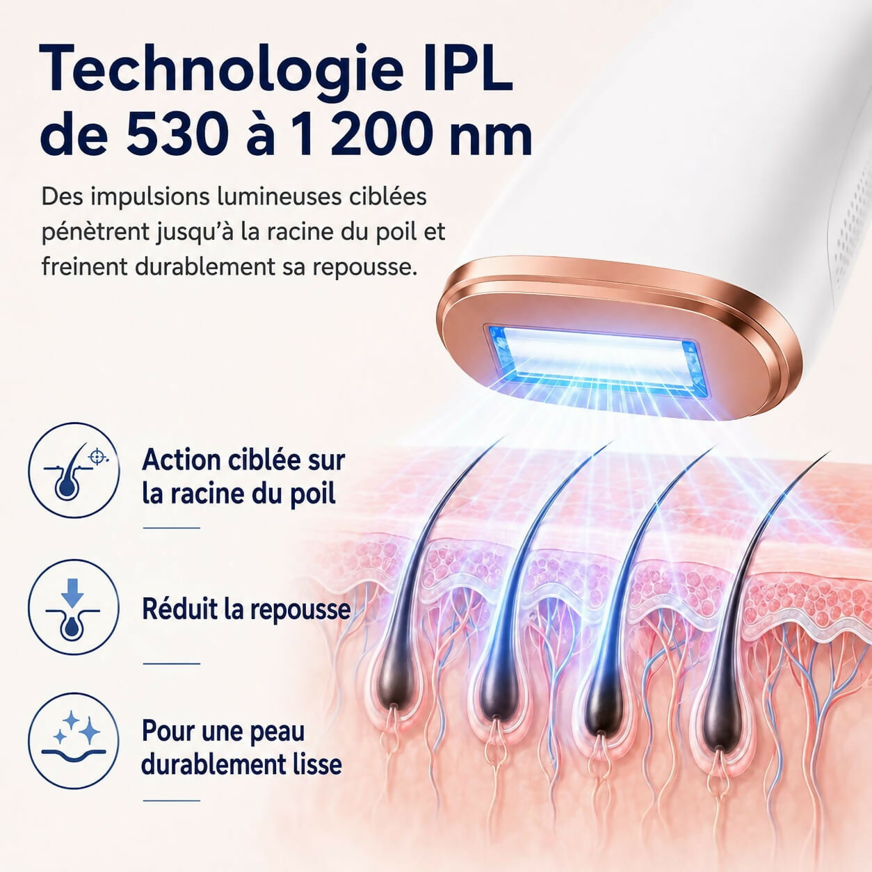 Oryzom ProSilk : technologie IPL avec fonction de refroidissement pour une peau durablement lisse